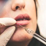 What to Know About Plastic Surgery Addiction